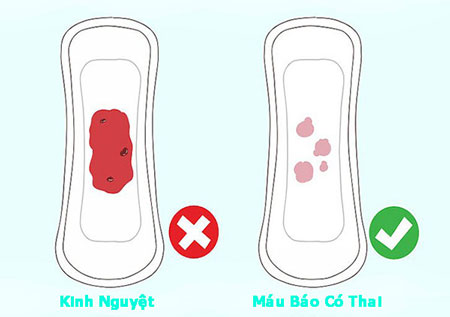 máu báo thai và kinh nguyệt